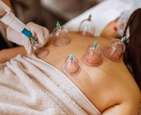 Cupping therapy with massage